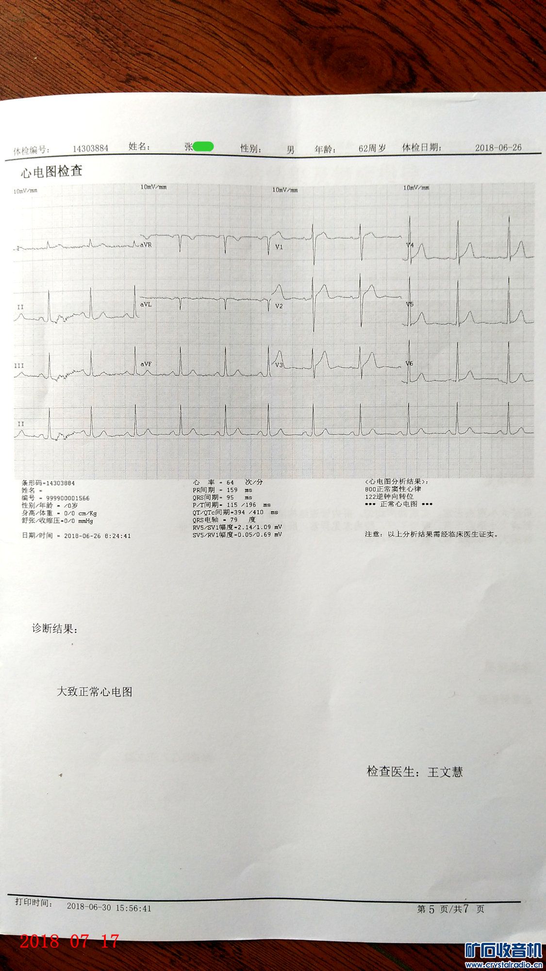 晒晒我今年的体检报告,还算满意